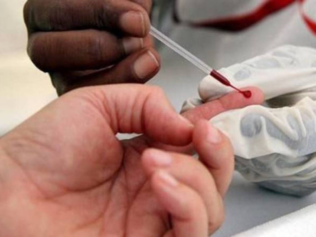 Molestia generó pruebas rápidas de VIH a estudiantes universitarios en Cartagena