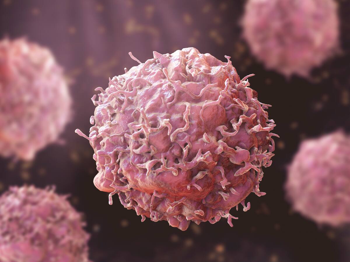 Reportaron casi 3.000 nuevos casos de cáncer en población joven de Risaralda