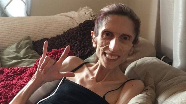 Rachael Farrokh, de 39 años y apenas 20kg de peso, ha hecho del signo no verbal del amor su símbolo para expresar optimismo y agradecimiento.. Foto: BBC Mundo