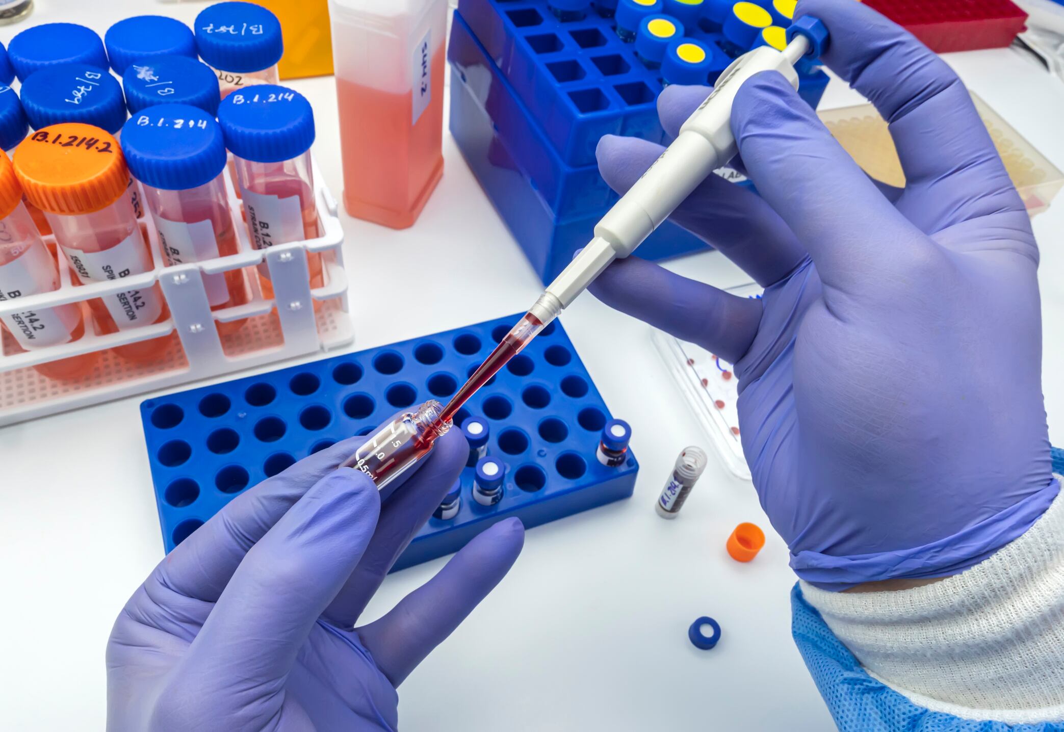 Aprueban análisis de sangre para detectar el cáncer de colon: ¿qué tan efectivo es?