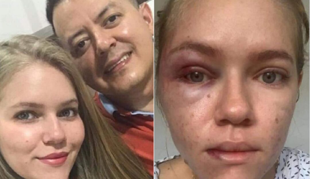 Ataque de concejal de Ocaña contra su esposa