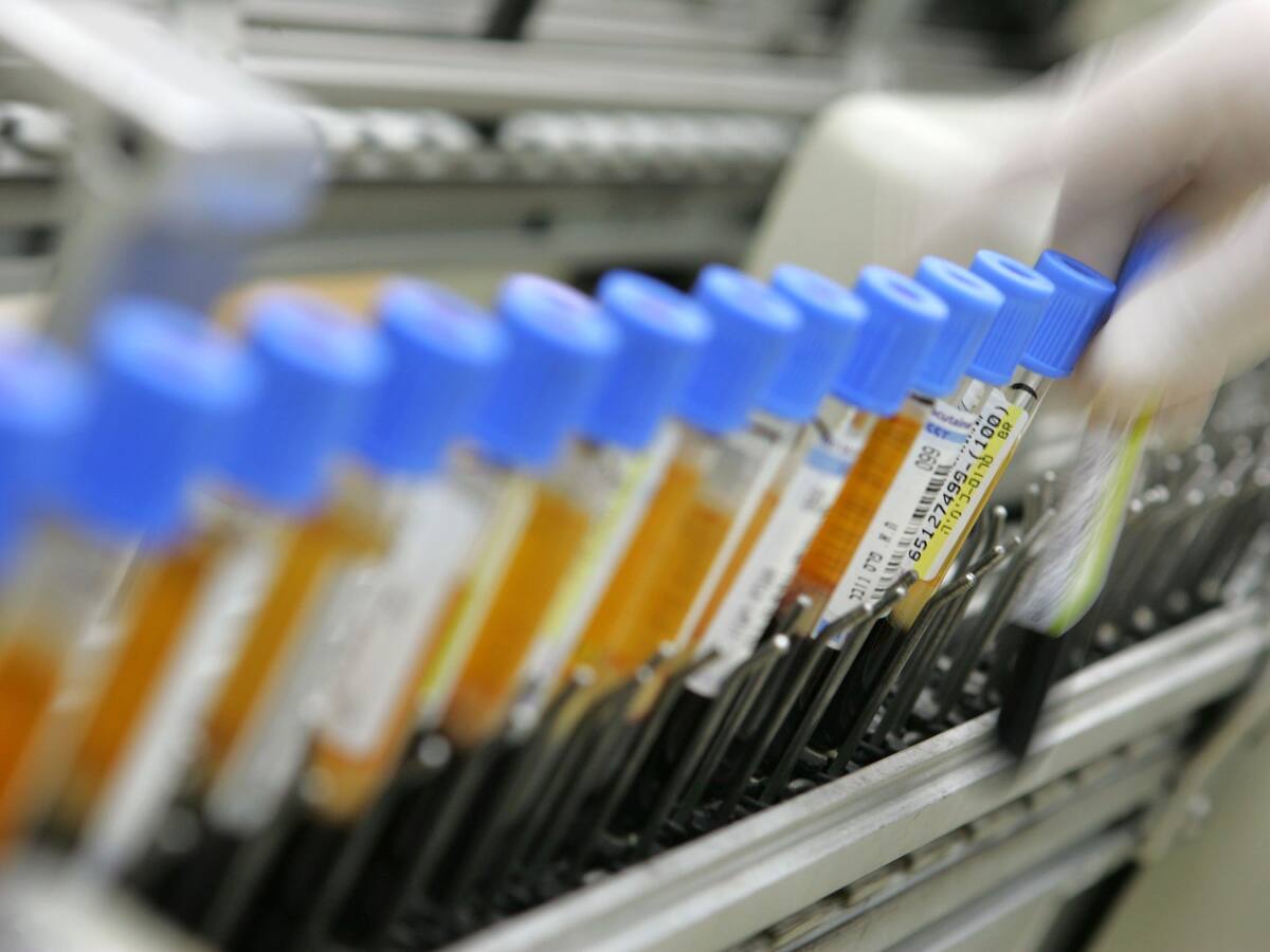 Sacrifican unos 40.000 pollos por gripe aviar tras orden de las autoridades de Japón