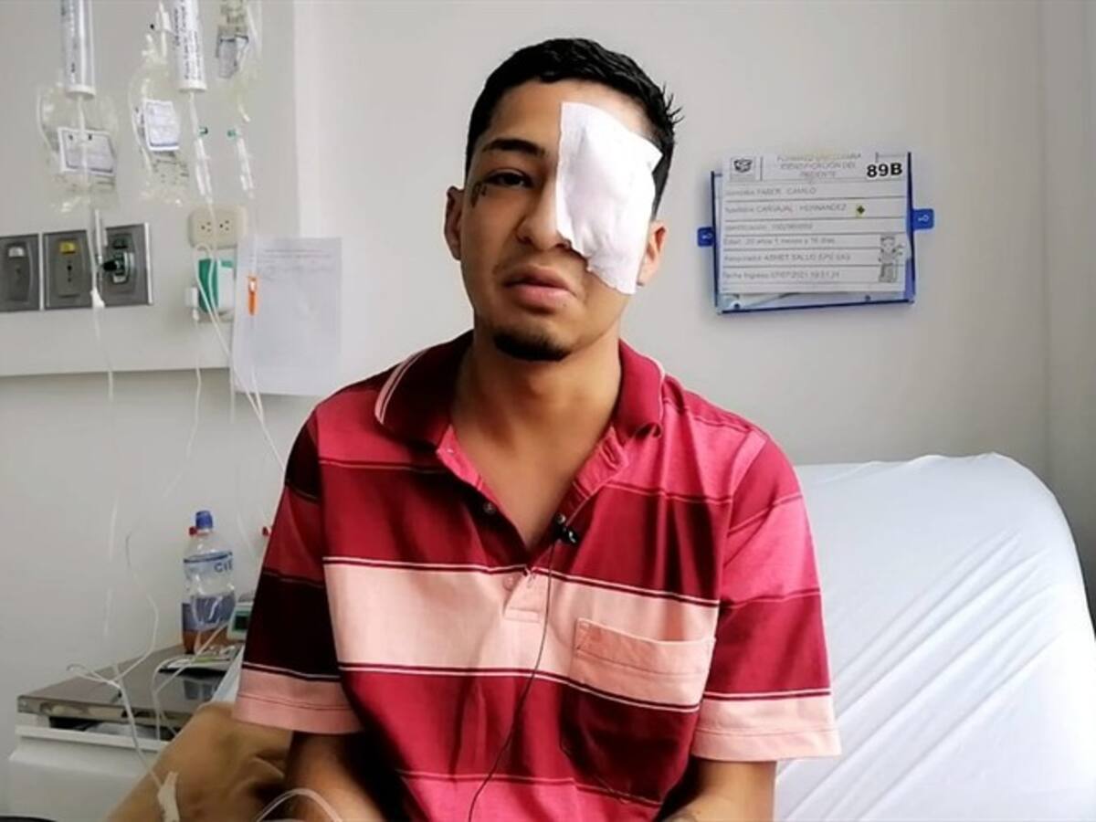 “Al que me disparó, que Dios lo bendiga”: joven que perdió un ojo en Popayán