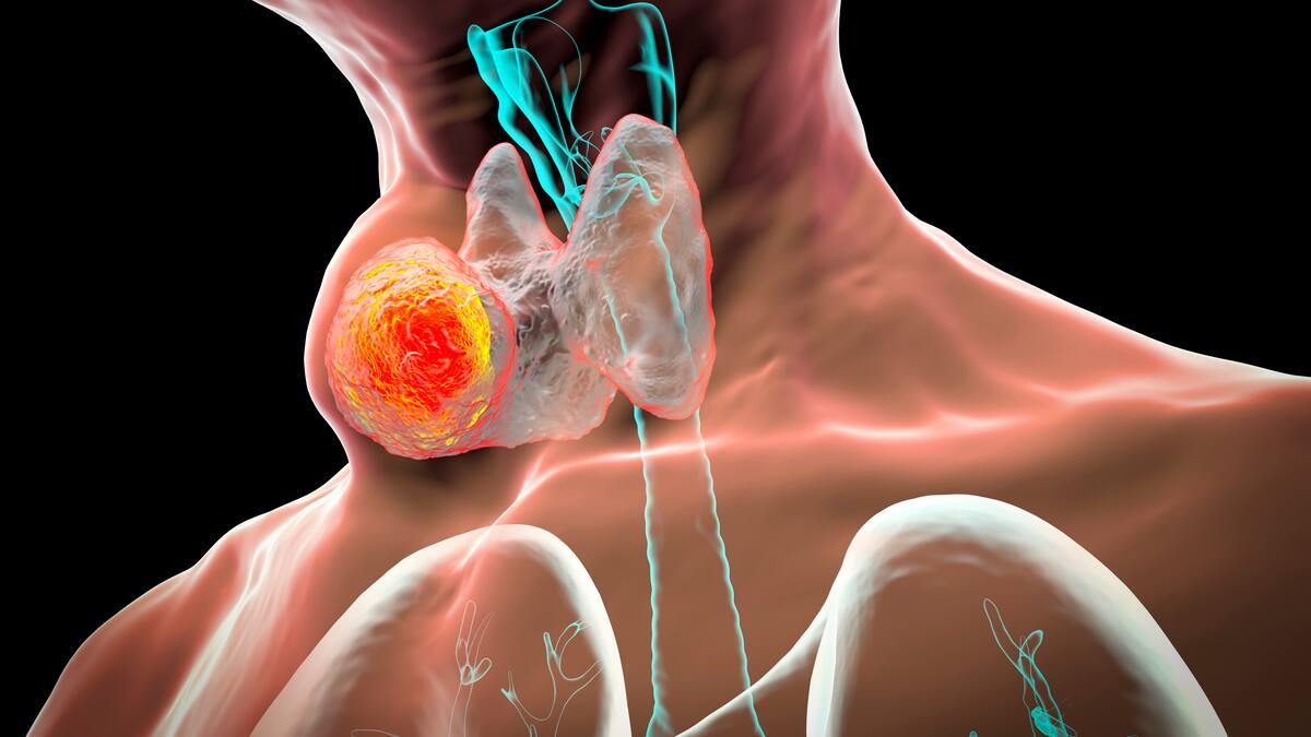 ¿Cómo cuidar la voz? Experta entregó tips y ejercicios para las cuerdas vocales