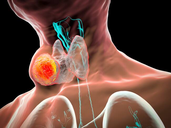 ¿Cómo cuidar la voz? Experta entregó tips y ejercicios para las cuerdas vocales