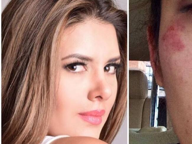 Actriz Juliana Daza denuncia golpizas de su expareja, Ricardo Torres