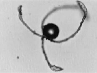 Esporas. Foto: BBC Mundo