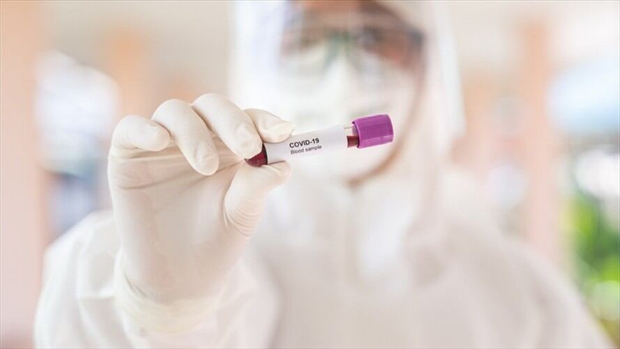 El análisis de la prueba rápida para saber si una persona es portadora o no de coronavirus, demora aproximadamente 20 minutos para conocer el resultado.. Foto: Getty Images