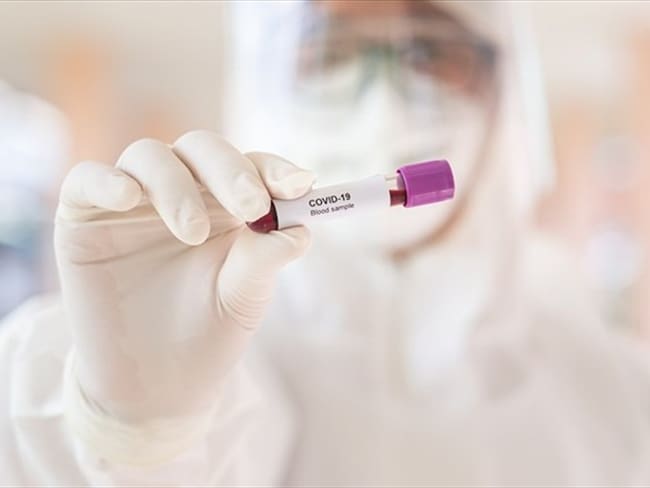 El análisis de la prueba rápida para saber si una persona es portadora o no de coronavirus, demora aproximadamente 20 minutos para conocer el resultado.. Foto: Getty Images
