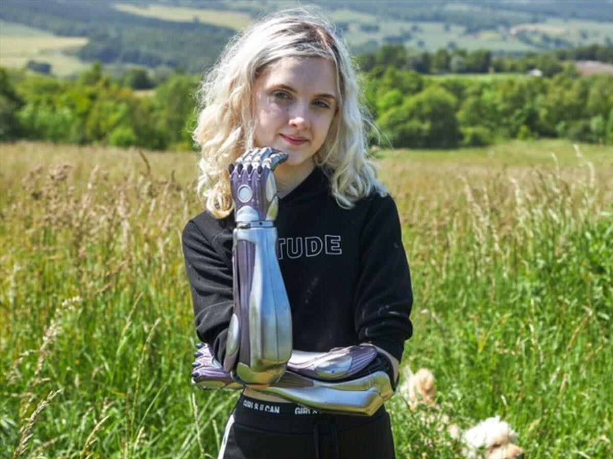 Joven que perdió sus antebrazos ahora modela, actúa y hasta toca el piano