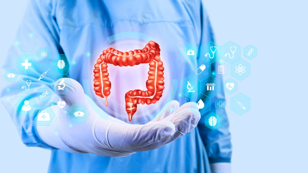 ¿Cuáles hábitos generarían divertículos en el colon? Gastroenteróloga responde
