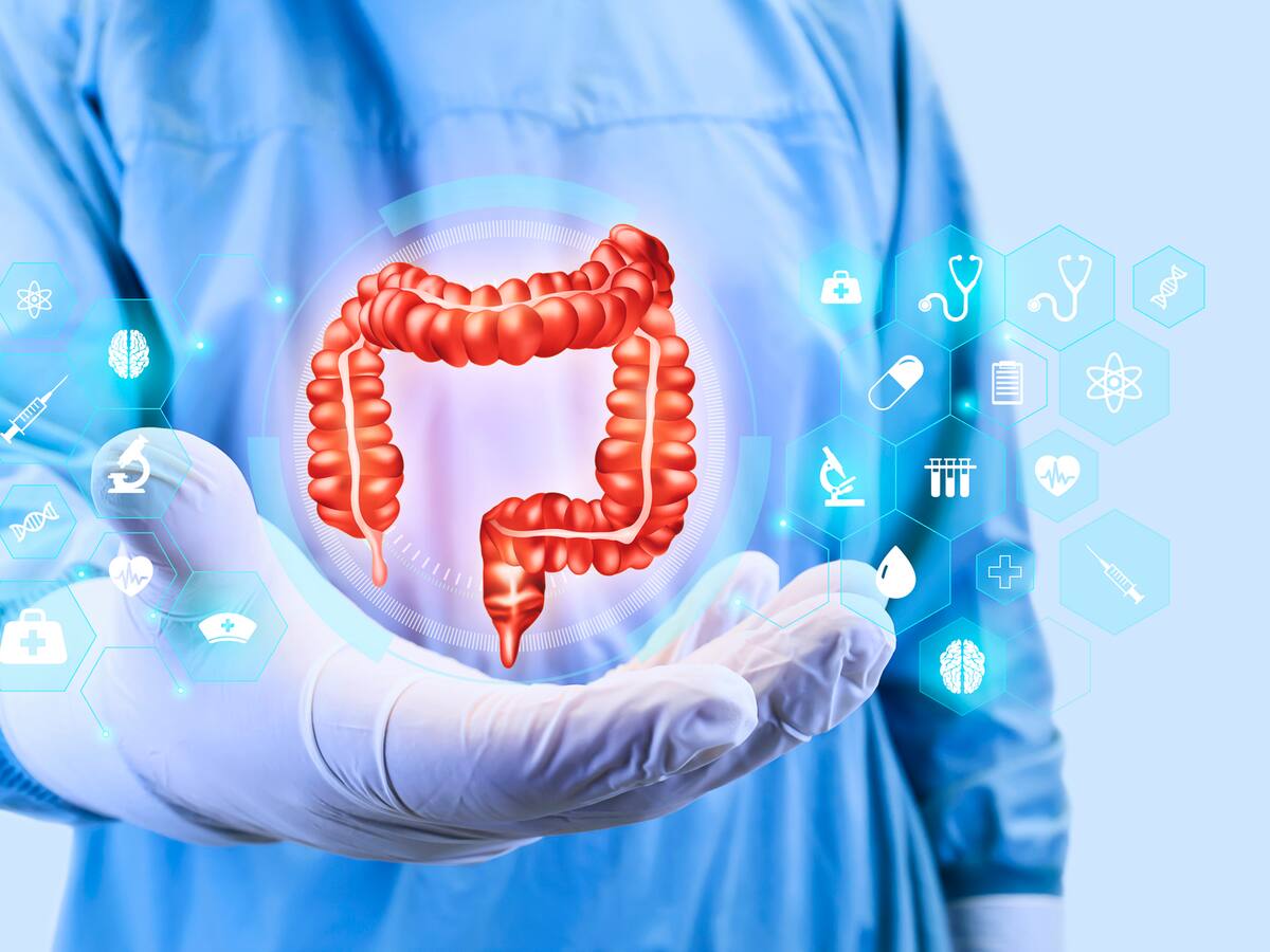 ¿Cuáles hábitos generarían divertículos en el colon? Gastroenteróloga responde