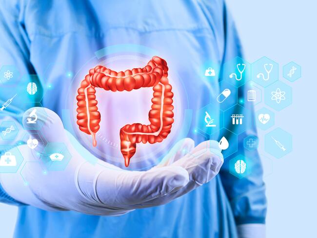 ¿Cuáles hábitos generarían divertículos en el colon? Gastroenteróloga responde