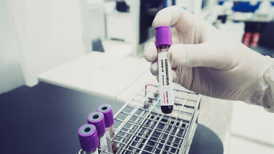 Casos de COVID-19 en Colombia. Foto: Getty Images