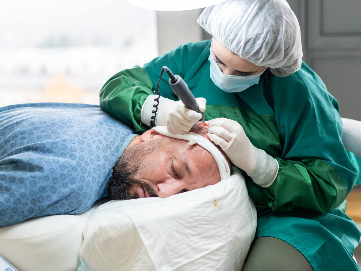 ABC de la restauración capilar y el trasplante de cabello explicado por experta