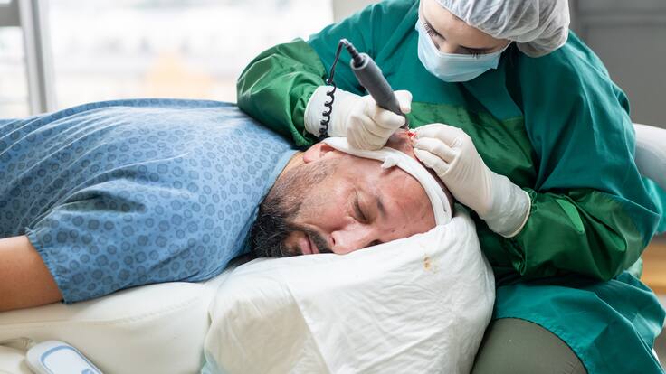 ABC de la restauración capilar y el trasplante de cabello explicado por experta