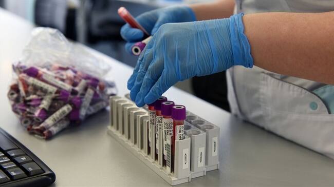 Rusia dice tener el primer antiviral efectivo contra el coronavirus. Foto: Getty Images