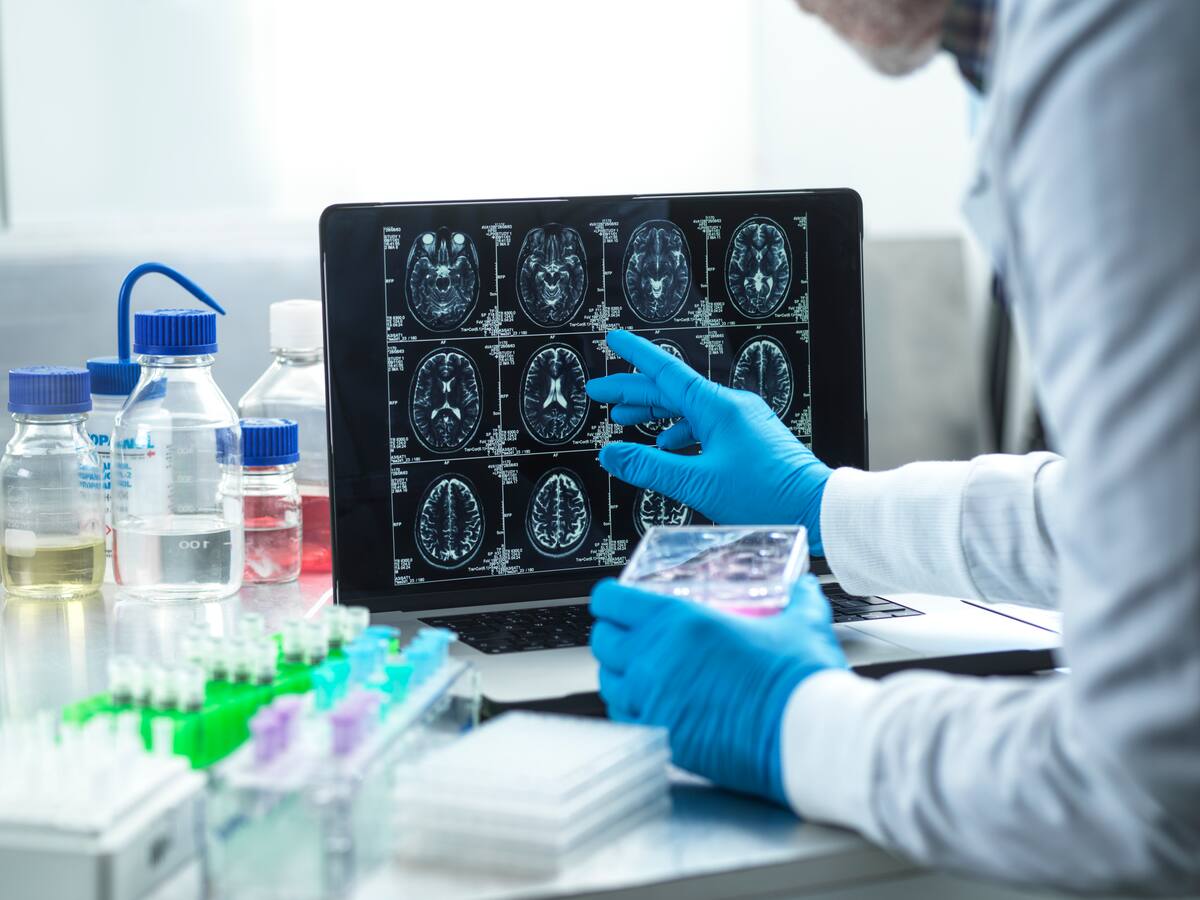 ¿Se puede prevenir el Alzhéimer desde una edad temprana? Neurólogo explicó los síntomas de alarma