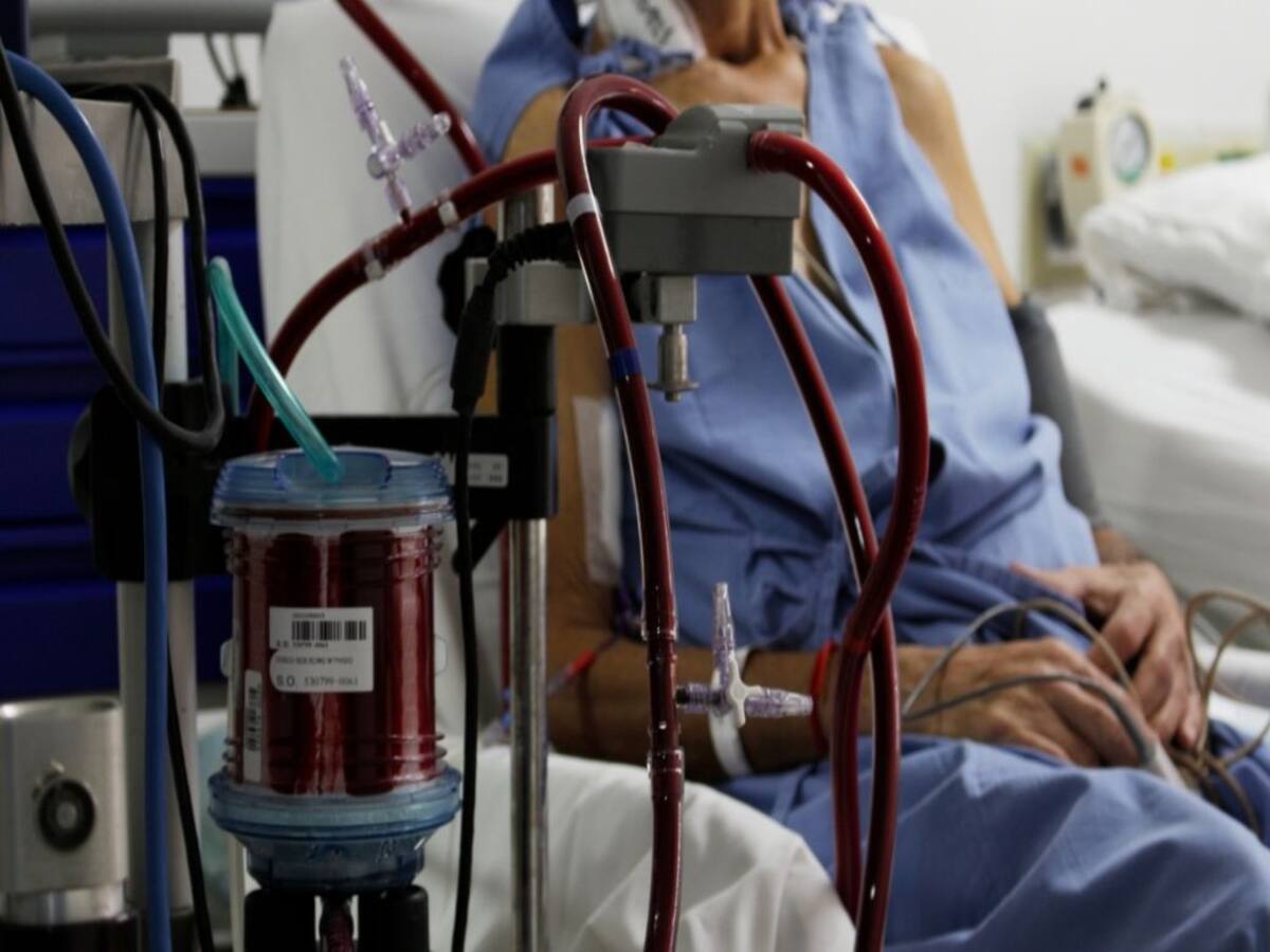 Solo hay una cama disponible en la Unidad ECMO en Santander