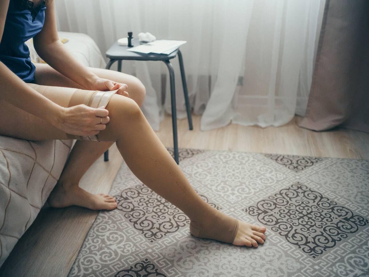 ¿Cuáles serían las personas más propensas a tener venas várices? Cirujano vascular explicó