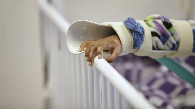 Tres nuevos casos de quemados se reportan esta semana en el departamento, esto de acuerdo con el más reciente informe de la Secretaría de Salud departamental. Foto: Colprensa