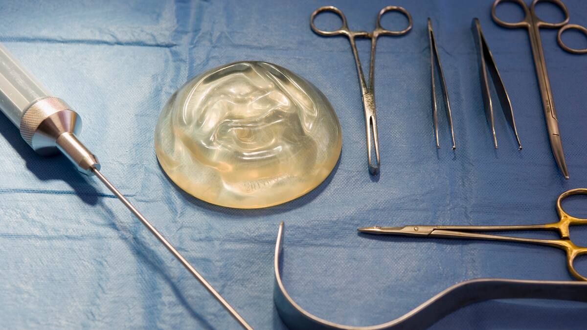 Implantes mamarios: ¿Es verdad que ya no es necesario quitarlos?