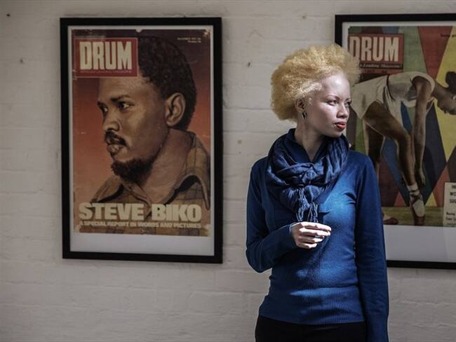 La modelo albina y sudafricana que está rompiendo con los estereotipos en esta industria