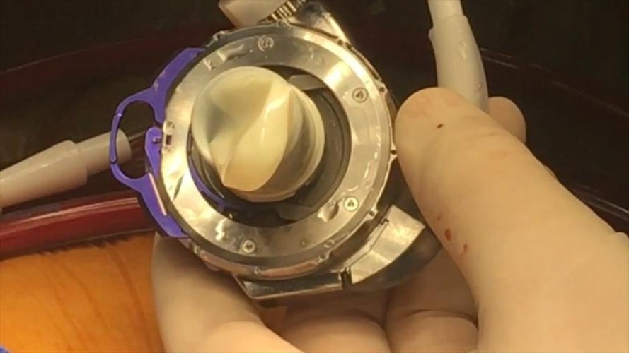 Desde el Hospital Internacional, Antonio Figueredo, cirujano cardiovascular, explica la importancia de este avance tecnológico.. Foto: W Radio