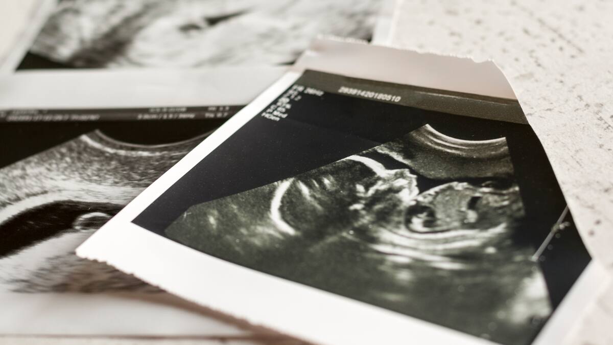 “Hay otras opciones distintas al aborto”: Fundación Casa de la Madre y el Niño