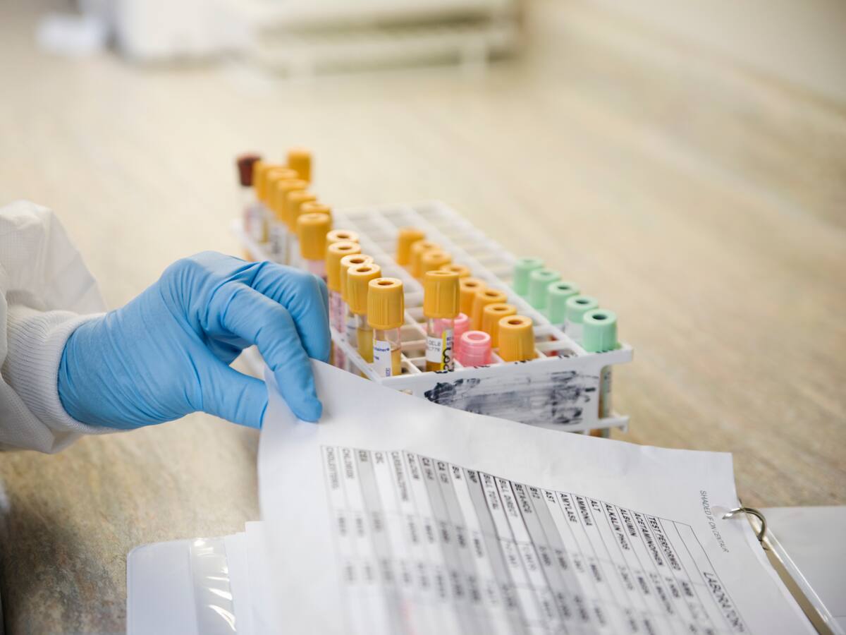 ¿Cuál es la importancia de hacerse exámenes médicos? Estas son las razones