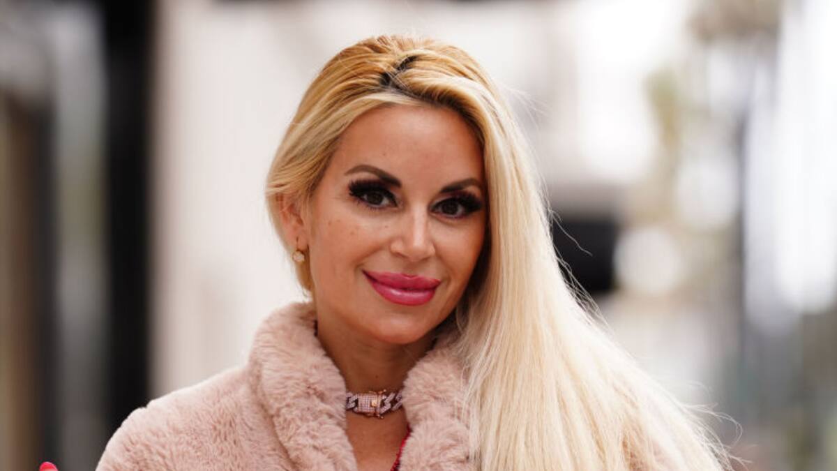 “Es para evitar el envejecimiento celular”: ‘Barbie Humana’ dio detalles del tratamiento con plasma