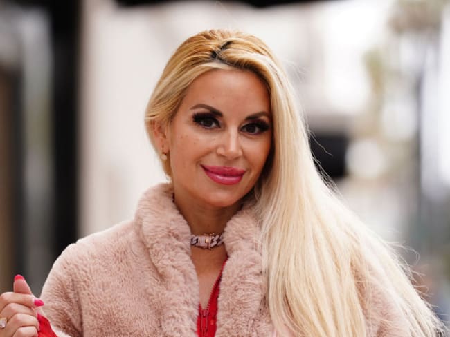 “Es para evitar el envejecimiento celular”: ‘Barbie Humana’ dio detalles del tratamiento con plasma