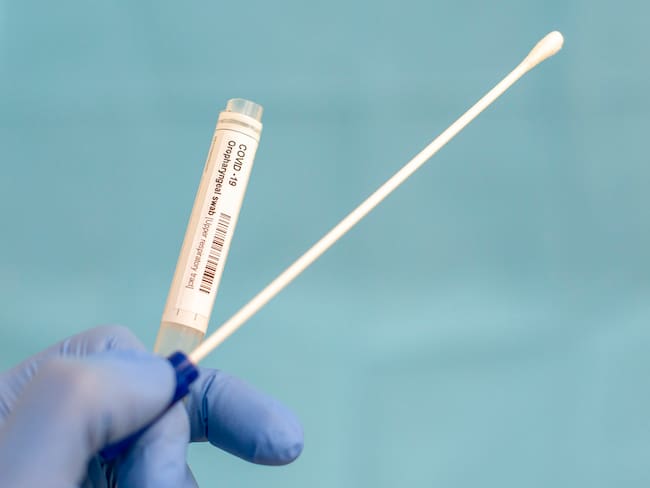 Acdac pide al Ministerio de Salud que permita que Avianca importe pruebas para hacer autoexamen COVID-19 a sus tripulaciones. Foto: Getty Images