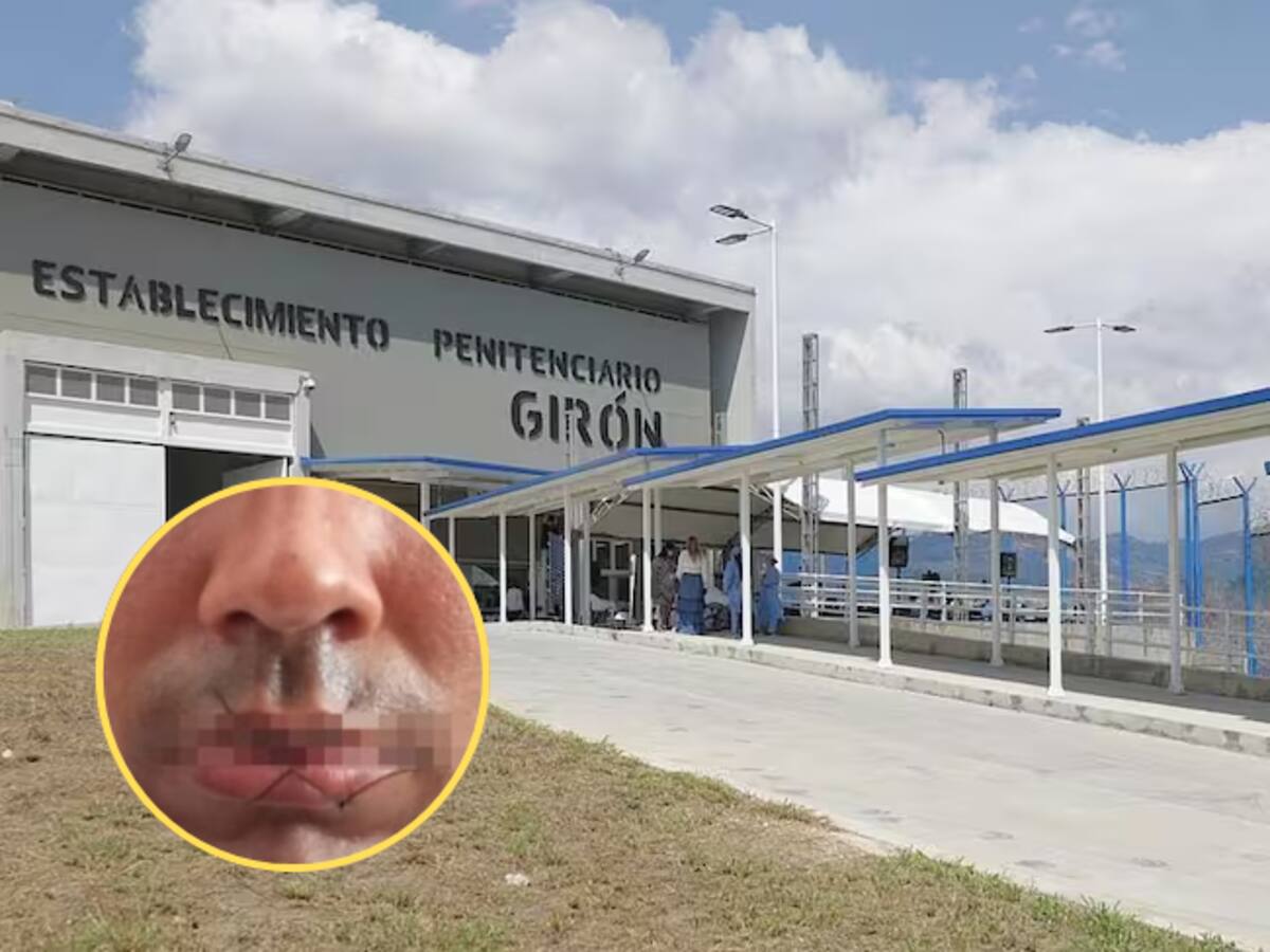 Dos presos se cosieron la boca para exigir traslados en una cárcel de Santander