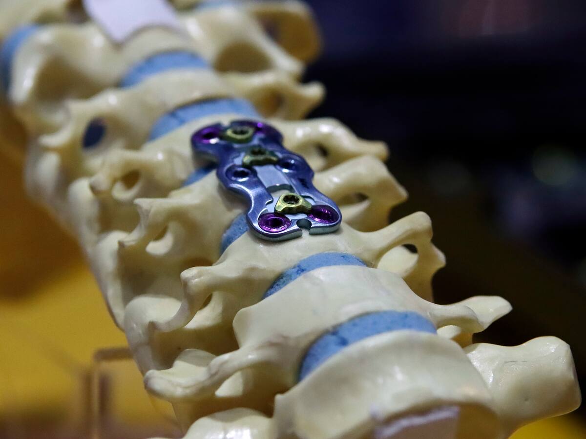 ¿Cuándo un dolor de espalda lleva a cirugía? Ortopedista explica signos de alarma