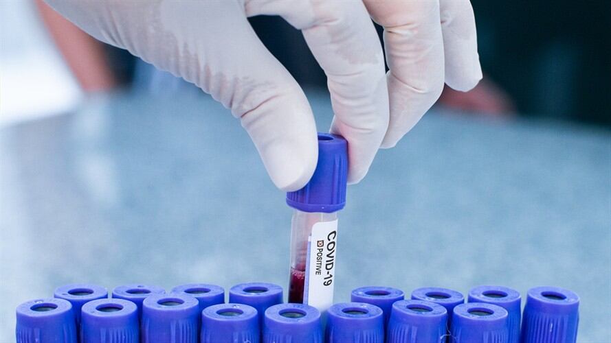 Minsalud advierte que no hay cura contra el coronavirus.. Foto: Getty Images