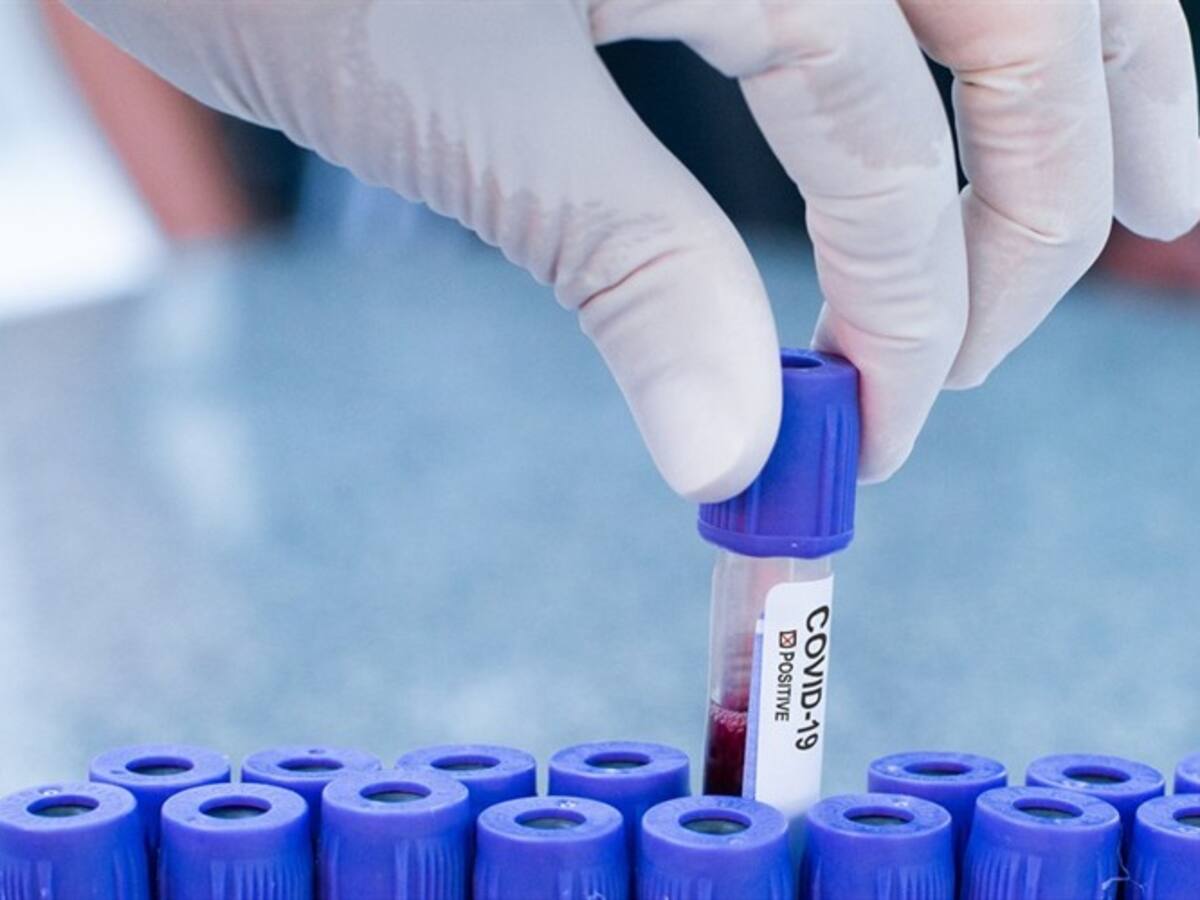 Kits de medicamentos no curan la COVID-19