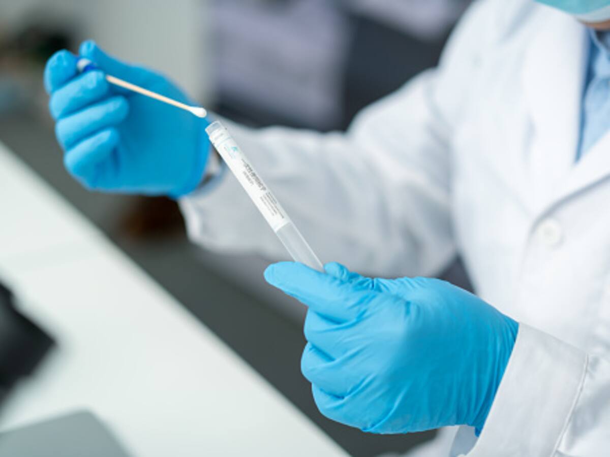 Coronavirus en Colombia: 5.532 casos nuevos y 162 fallecidos para este domingo