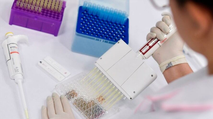 Empresa vendió como propios 1,5 millones de test rápidos de coronavirus hechos en China. Foto: Getty Images