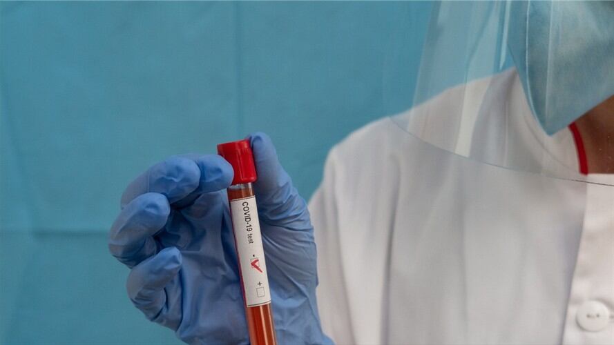 Casos de COVID-19 en Colombia. Foto: Getty Images