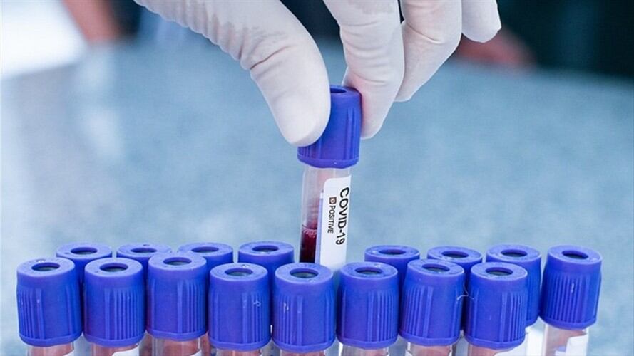 El mandatario municipal y los funcionarios se encuentran aislados. . Foto: Getty Images / LUCAS NINNO