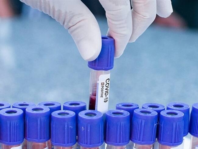 El mandatario municipal y los funcionarios se encuentran aislados. . Foto: Getty Images / LUCAS NINNO