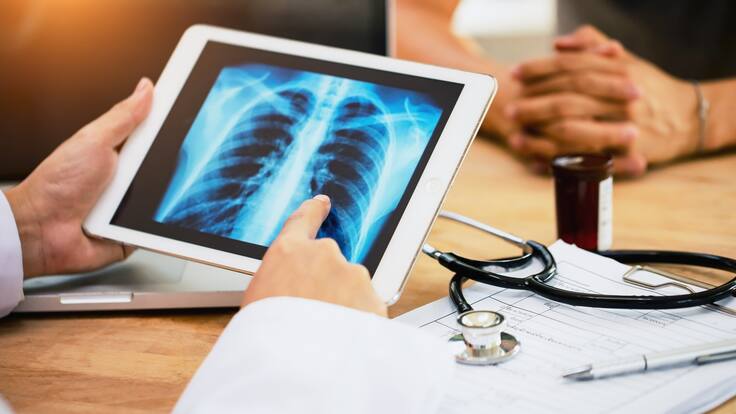 Cáncer de pulmón: ¿qué factores aumentan el riesgo de padecerlo?