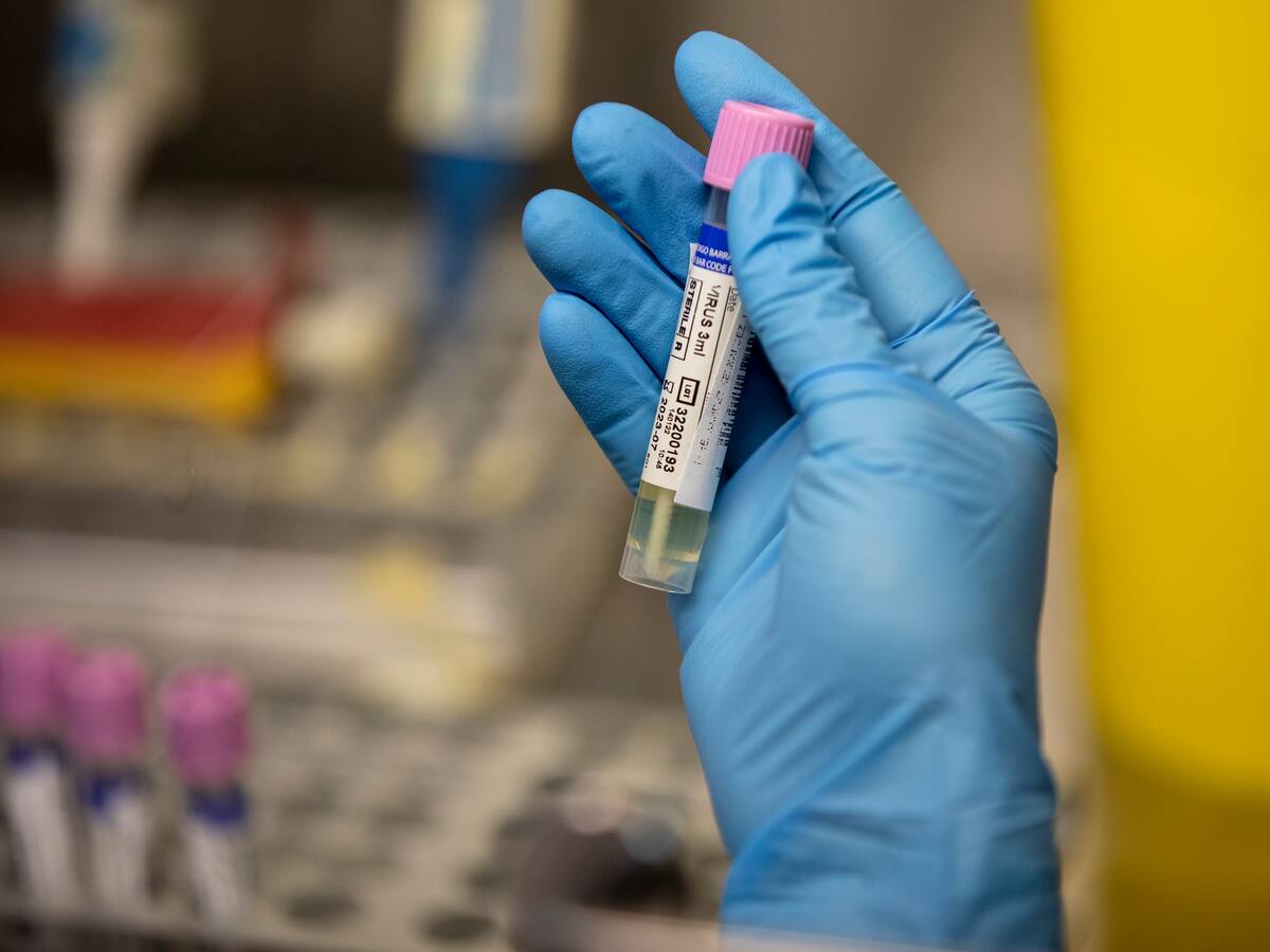 Brasil anuncia la compra de vacunas contra la viruela del mono