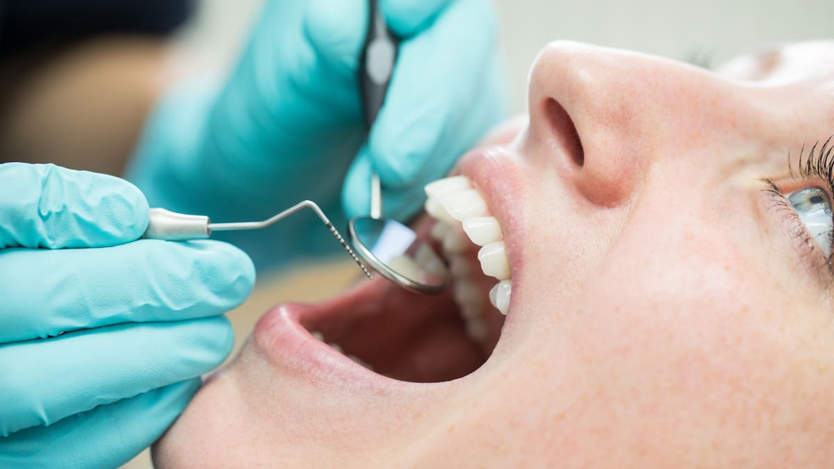 ¿Cómo saber si tengo cáncer oral? Experta respondió y detalló síntomas de alerta