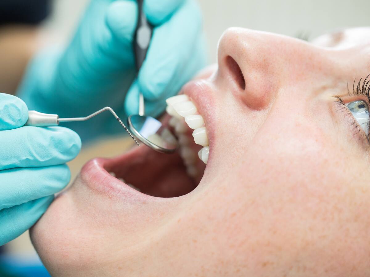 ¿Cómo saber si tengo cáncer oral? Experta respondió y detalló síntomas de alerta