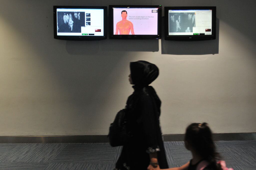 Alcaldía aclara que en Bogotá no se presentan casos de viruela del mono y llama a la calma / foto de referencia. Getty Images