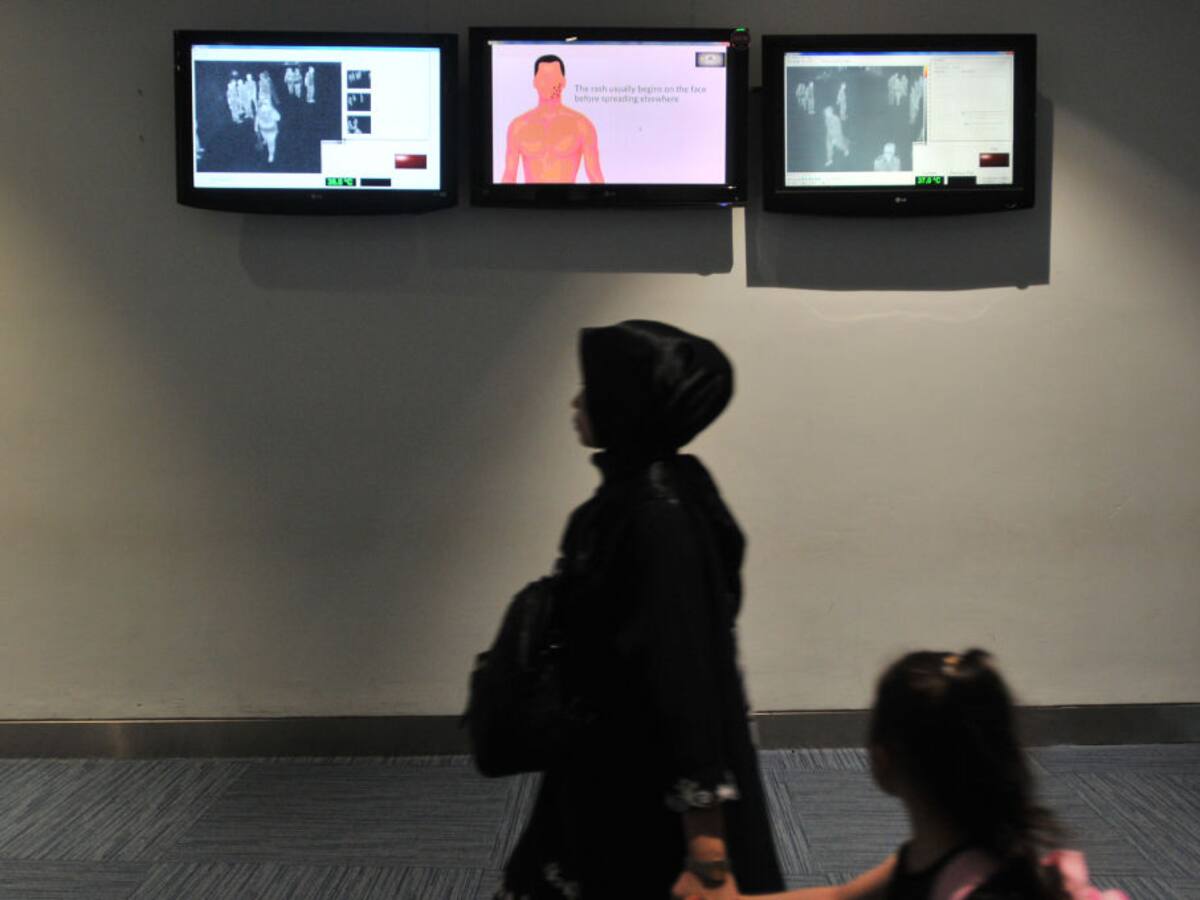 Alcaldía aclara que en Bogotá no se presentan casos de viruela del mono y llama a la calma