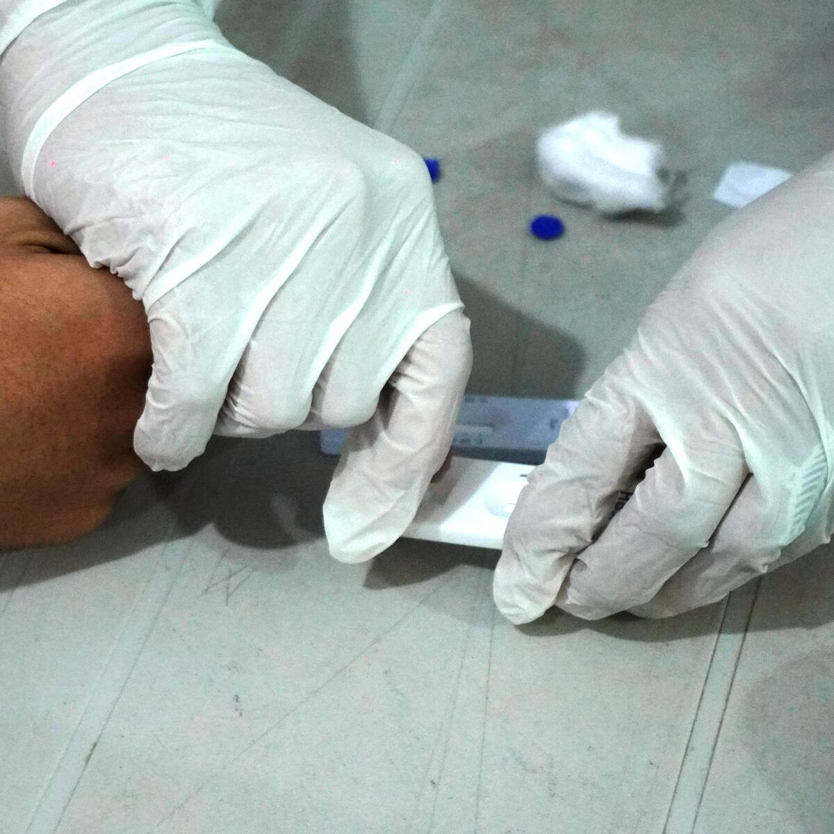 Por aumento de casos, refuerzan diagnóstico de hepatitis e infección de transmisión sexual en Bogotá