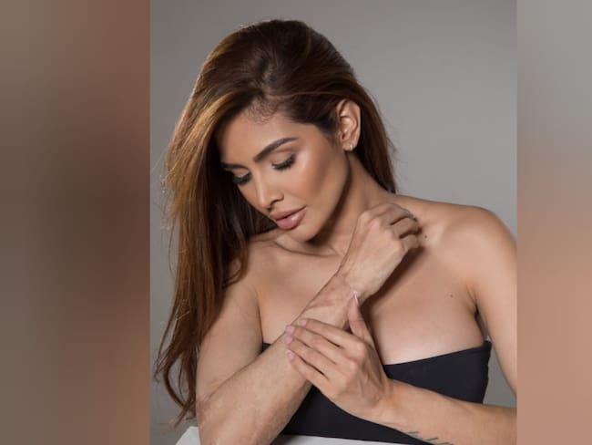 “Mis cicatrices son marcas que llevo con orgullo”: Paola Santos